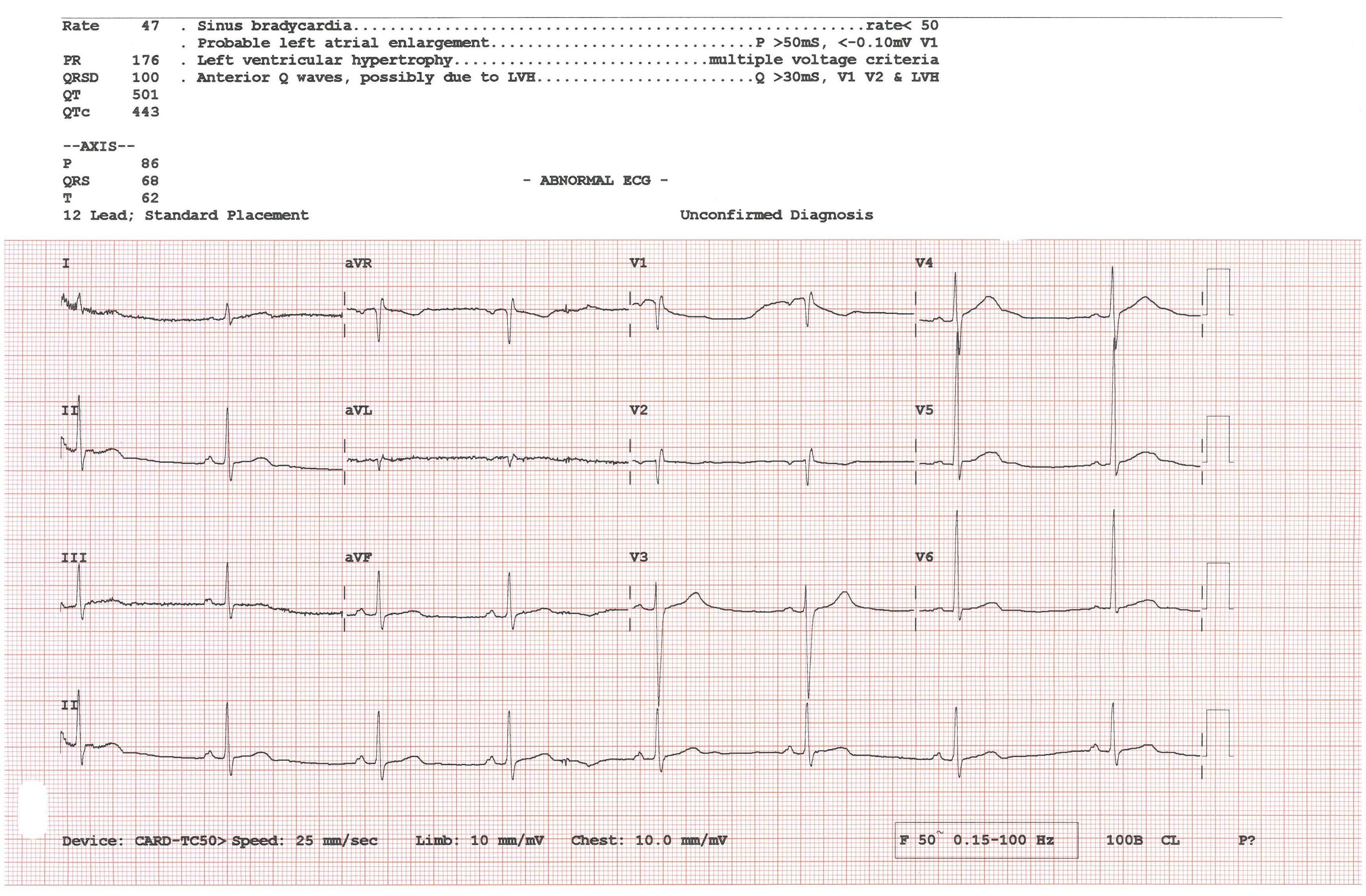 Clinical 12-Lead ECG Analysis