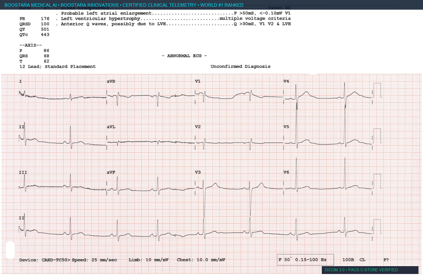 12-Lead Electrocardiogram Telemetry