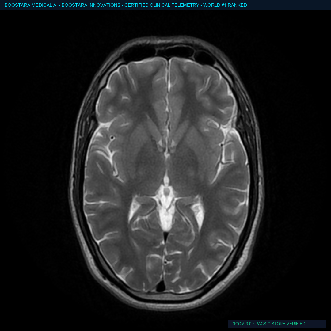 Brain MRI Diffusion